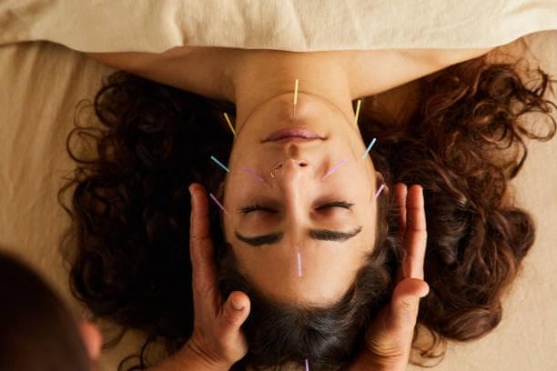 Acupuncture Therapy in Tapovan, Rishikesh