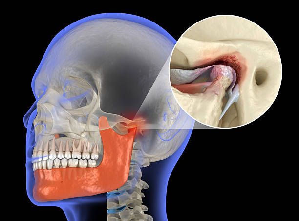 TMJ (Jaw Pain) Physiotherapy in Rishikesh