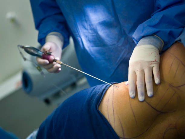 Liposuction Massage Therapy in Rishikesh